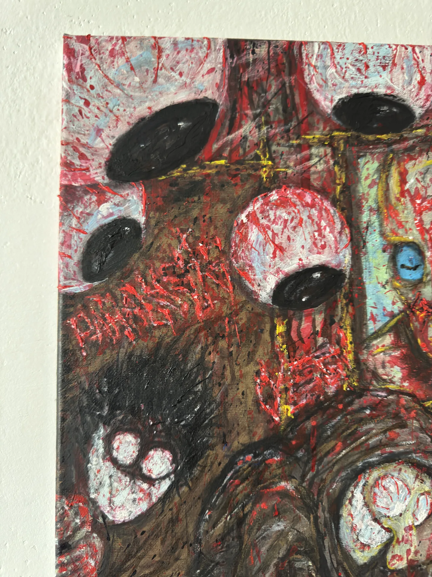 Paralysis – view 5