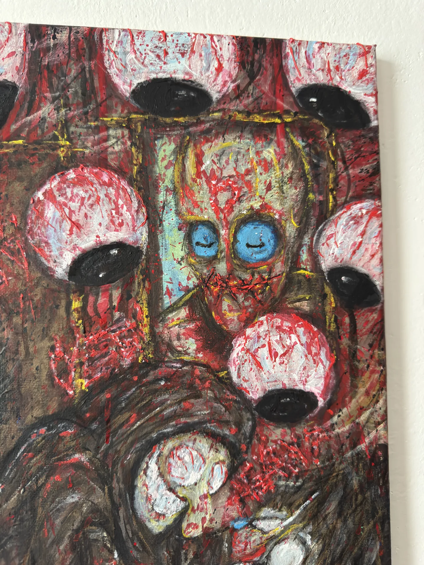 Paralysis – view 6